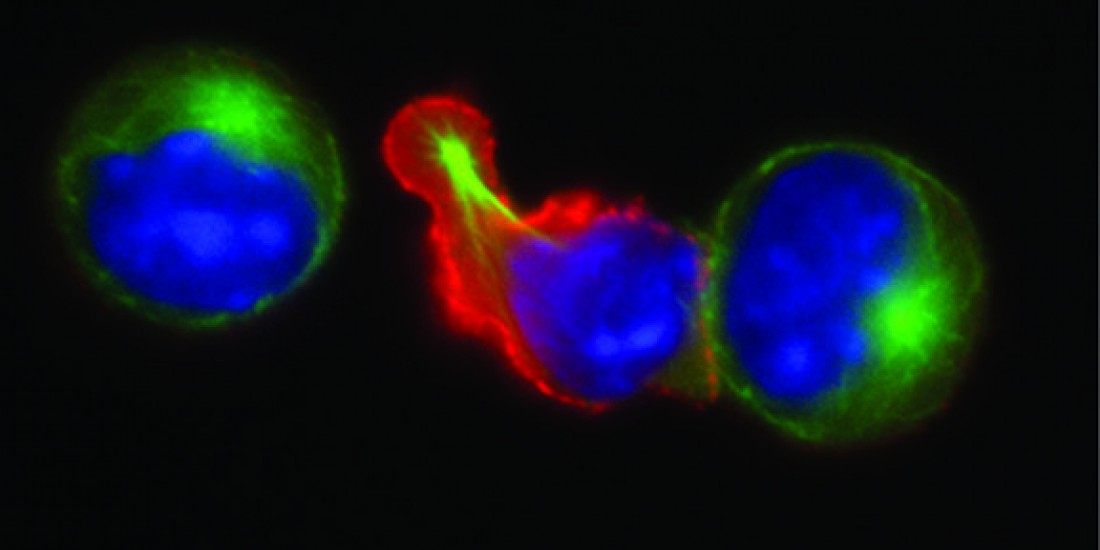 Understanding Immune cell Motility